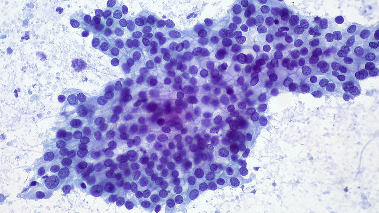 Biological Security - Weekly Update - March 2022